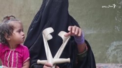 تاج مینه وايي چاودنه کې تر معیوبېدو وروسته یې ښه ورځ نه ده لیدلې