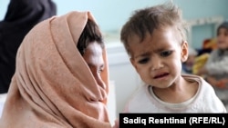 په کندهار کې په خوارځواکي اخته ماشوم