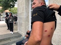 Jedan od demonstranta sa povredama od gumenih metaka