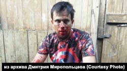 Dmitry Miropoltsev said he suffered what appeared to be a broken nose and lost two teeth during the attack.