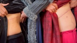 Organs And Children Sold Amid Afghan Economic Collapse