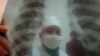 WHO Moving On Fast Treatment For Drug-Resistant TB